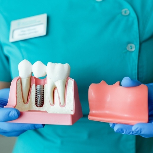 Model smile comparing dental implants to natural teeth