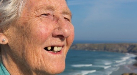 Dental patient with missing single tooth