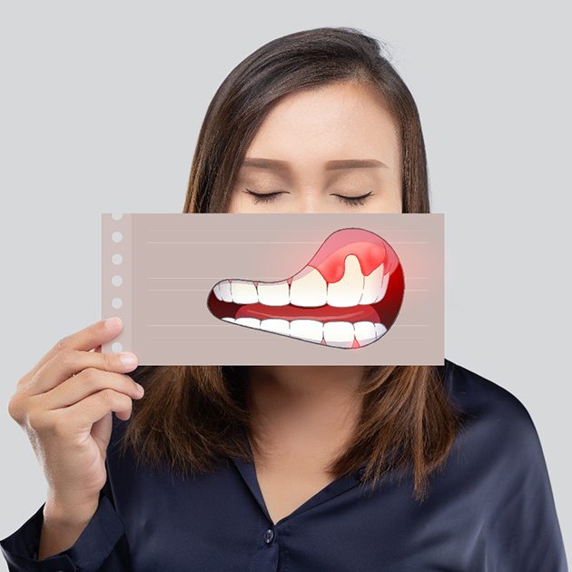 Woman with eyes closed holding picture of gum disease in front of her face