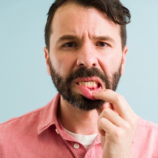 Man with beard pulling down lower lip to reveal dark red gums