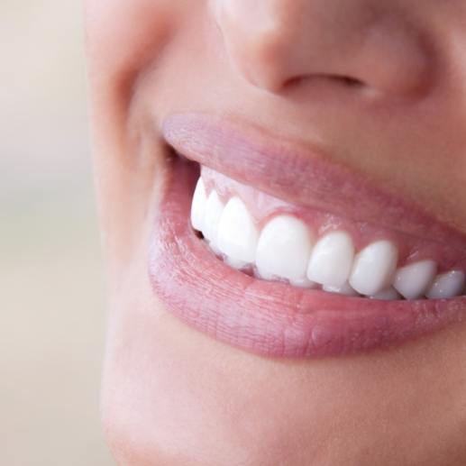 Close up of smile after full mouth reconstruction