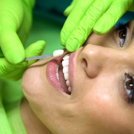 Dentist placing veneers