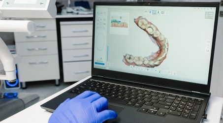 a dentist looking at a digital image of teeth